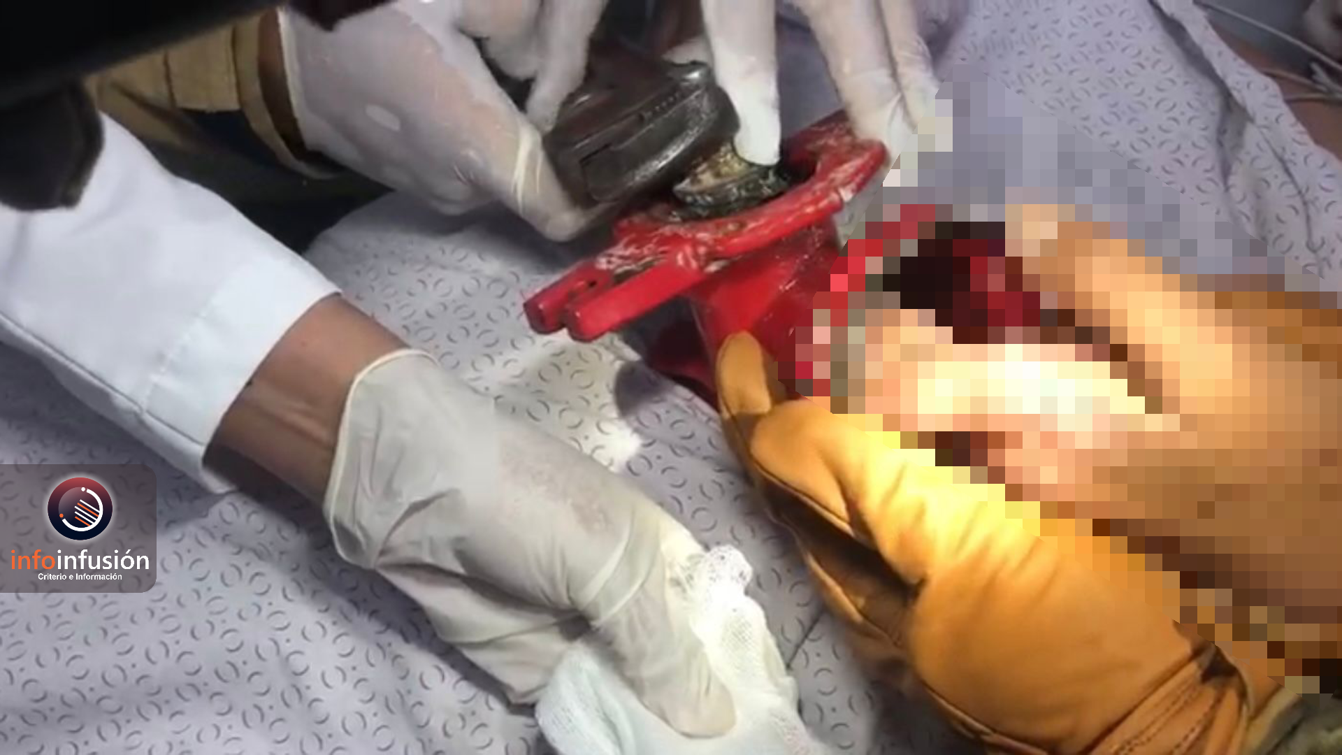 Mujer queda prensada de una mano en un molino de maíz